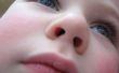 Vakuum-Entfernung des Objekts im Kind die Nase stecken
