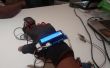E-Health-Handschuh (Intel IoT)