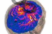 Von MRT-Bilder, elektrisches Feld: Modellierung Transcranial magnetische Anregung