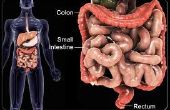 CED: Das Heilmittel für Crohn und Colitis ulcerosa