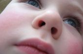 Vakuum-Entfernung des Objekts im Kind die Nase stecken