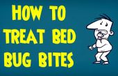 Gewusst wie: behandeln von Bettwanzen gebissen | Behandlung von Bisse von Insekten und Insekten